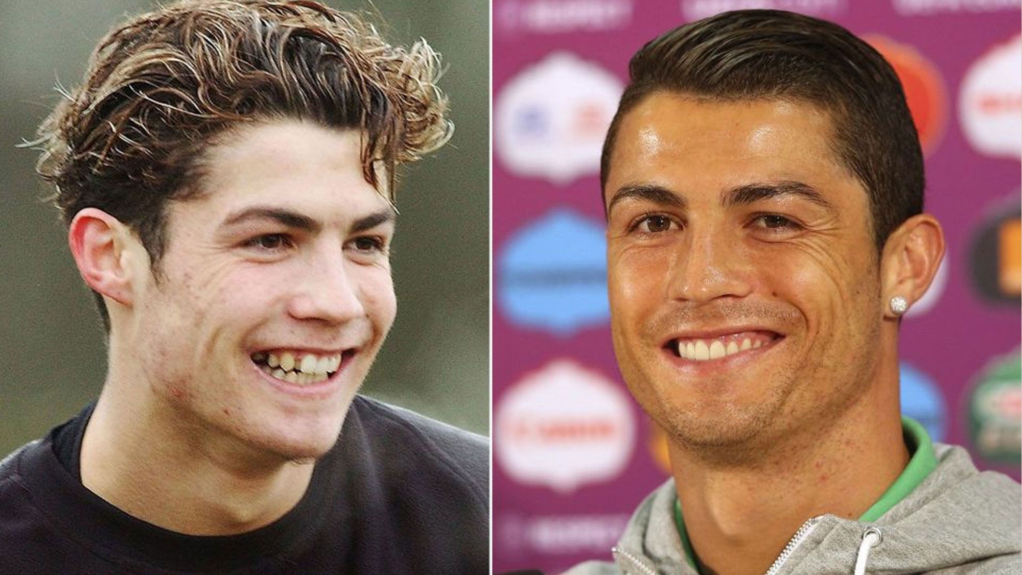 Comparación de Cristiano Ronaldo en su juventud y adultez.