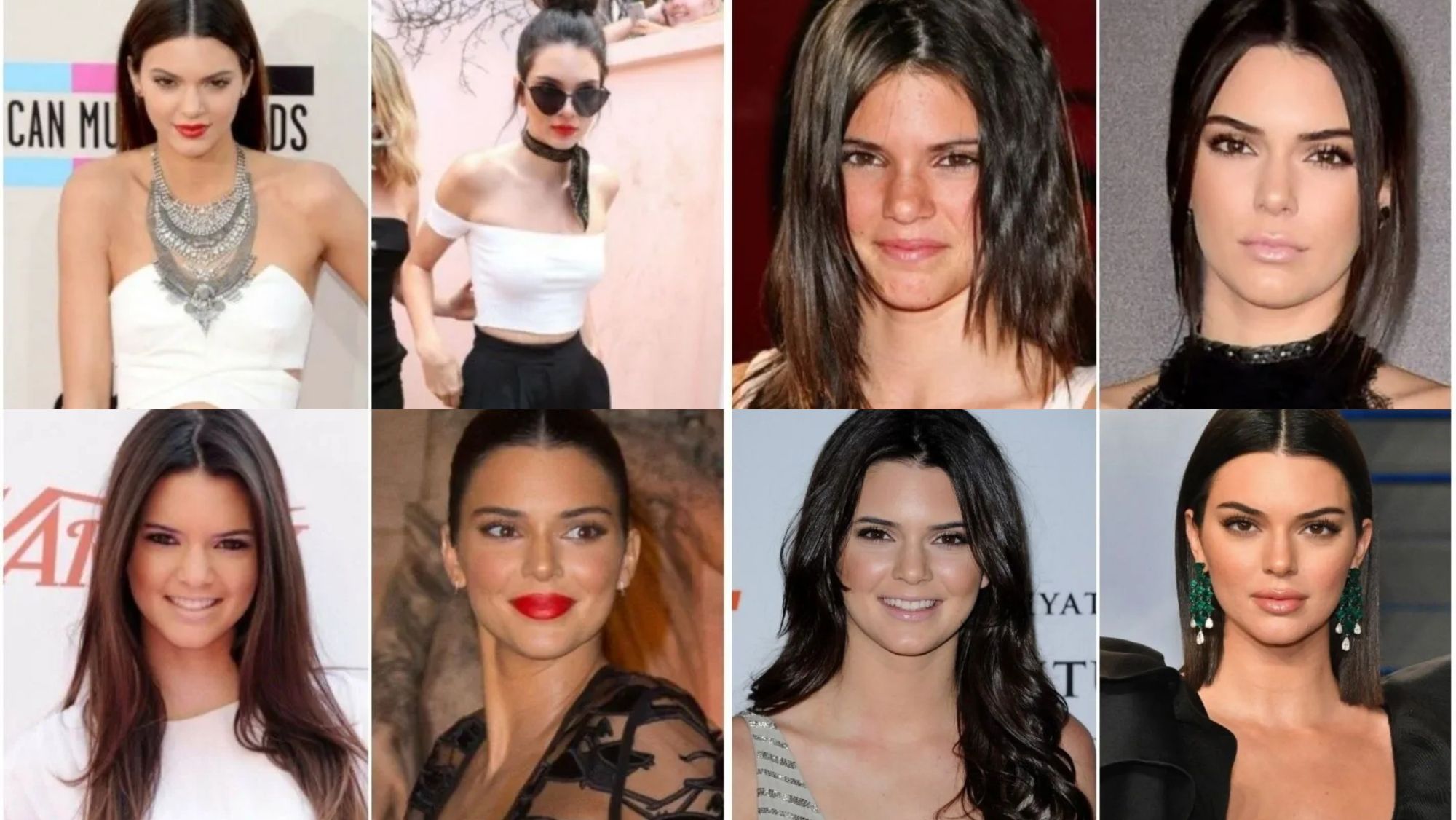 kendall Jenner antes y después kendall Jenner antes y después