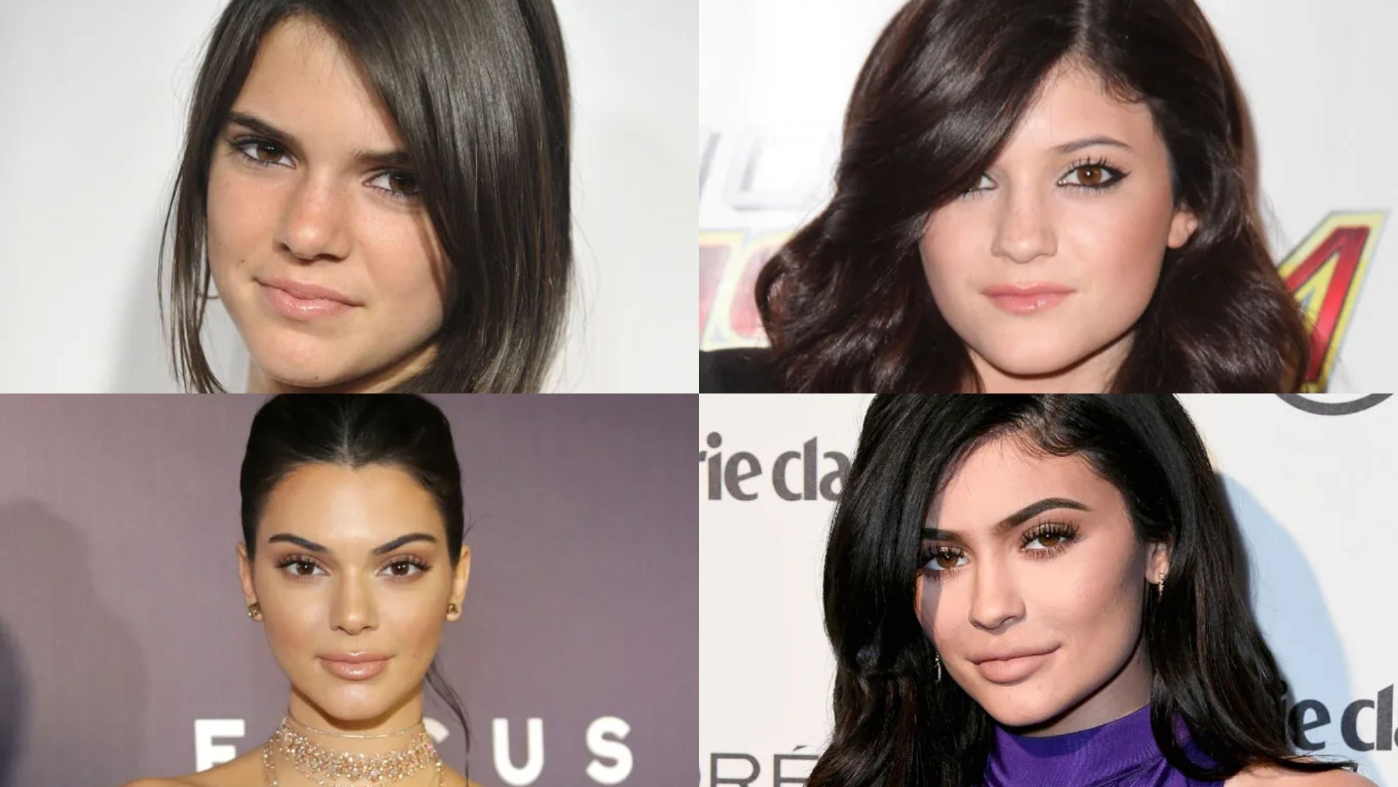 Kendall y Kylie antes y después Kendall y Kylie antes y después