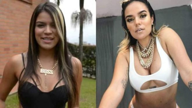 KAROLG antesydespues LP1281688 MG73043087 KAROLG antesydespues LP1281688 MG73043087