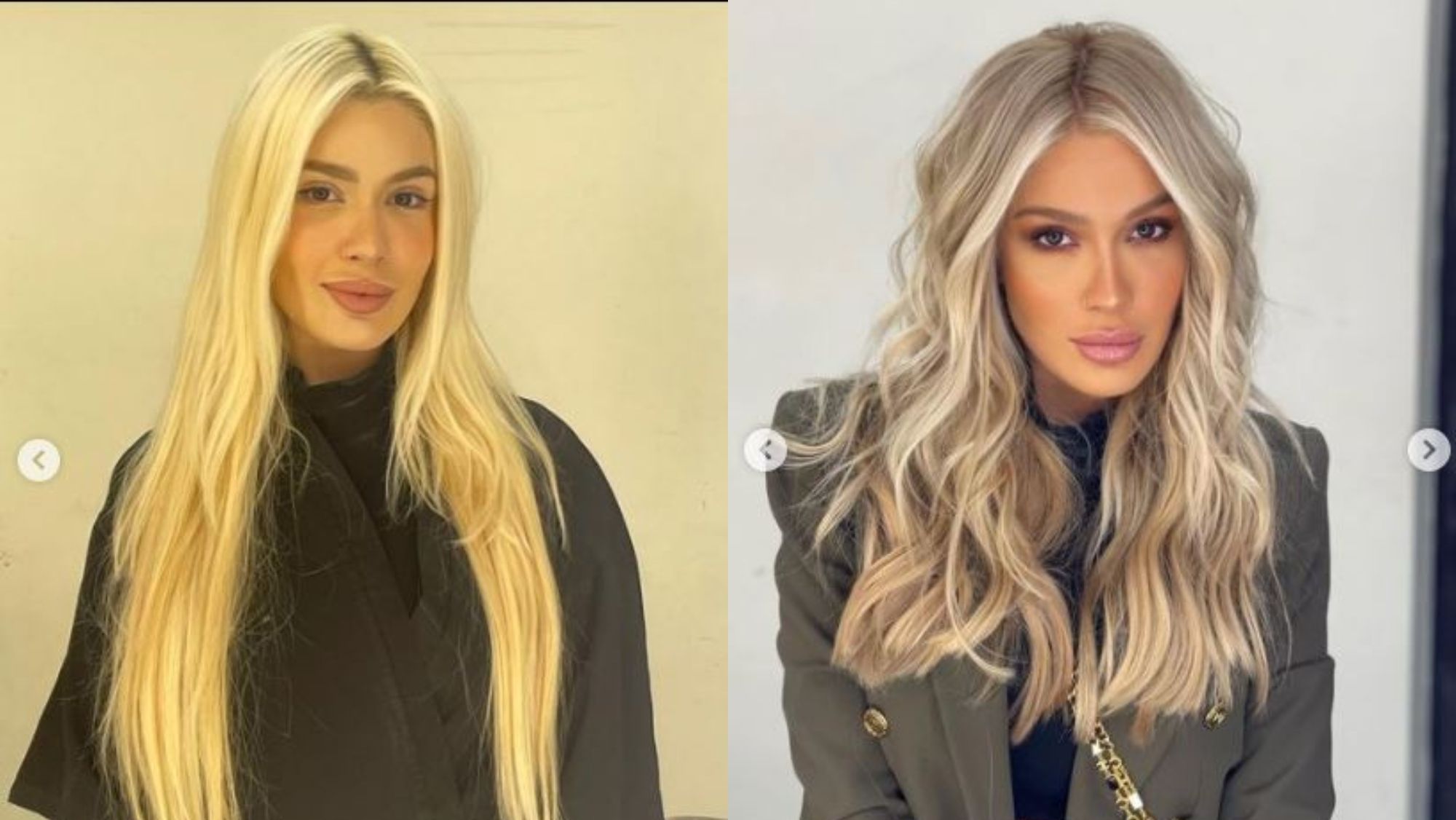 Karoline Lima antes y después