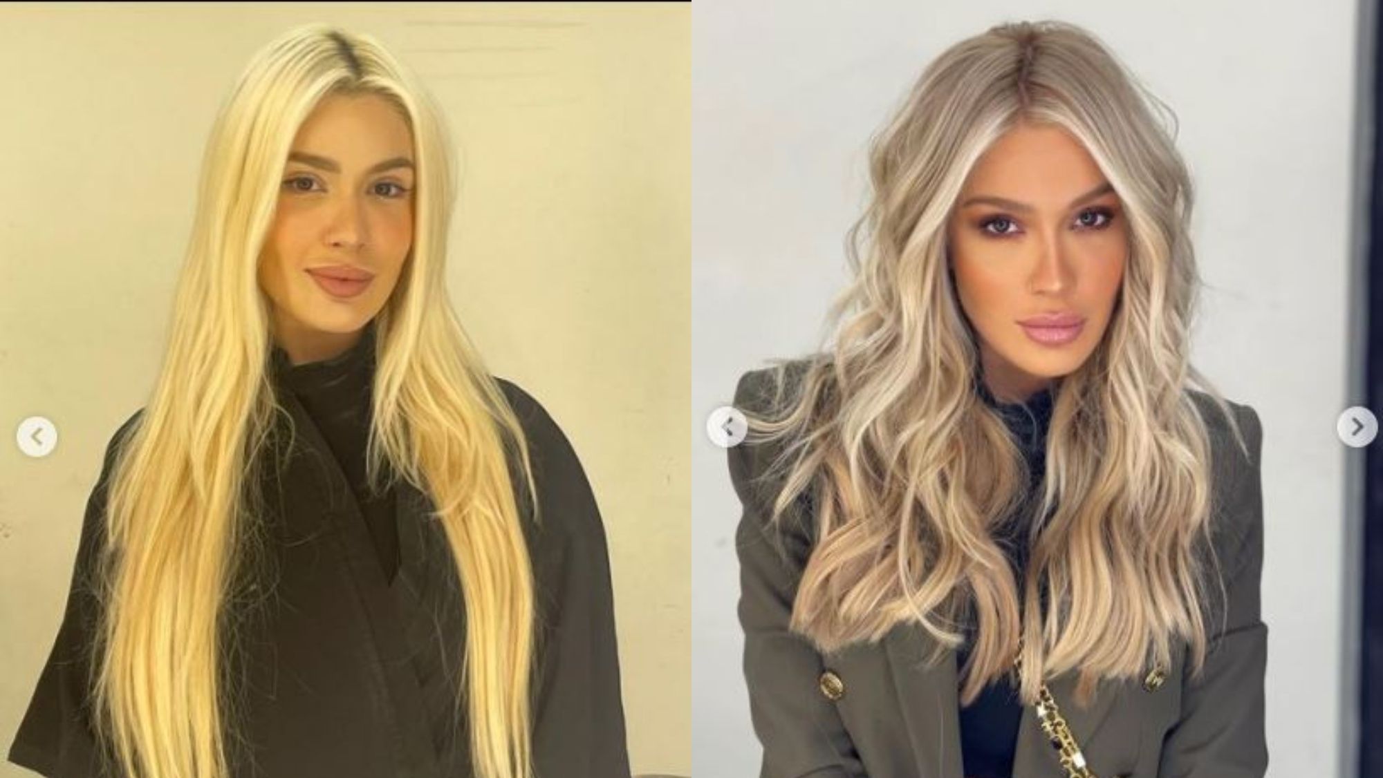 Karoline Lima antes y después Karoline Lima antes y después