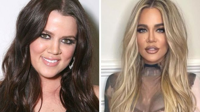 El antes y después de Khloé Kardashian El antes y después de Khloé Kardashian