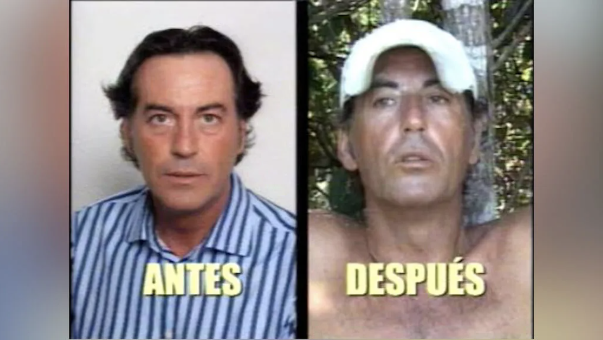 Pipi Estrada antes y después