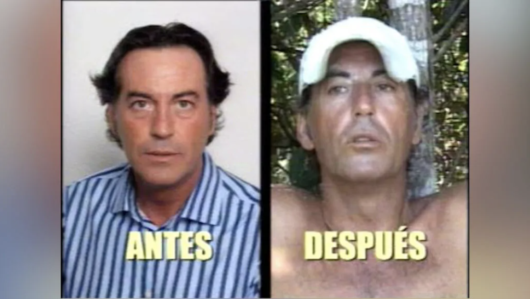 Pipi Estrada antes y después Pipi Estrada antes y después