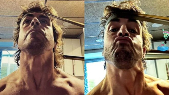 El antes y el después del cuello de Fernando Alonso