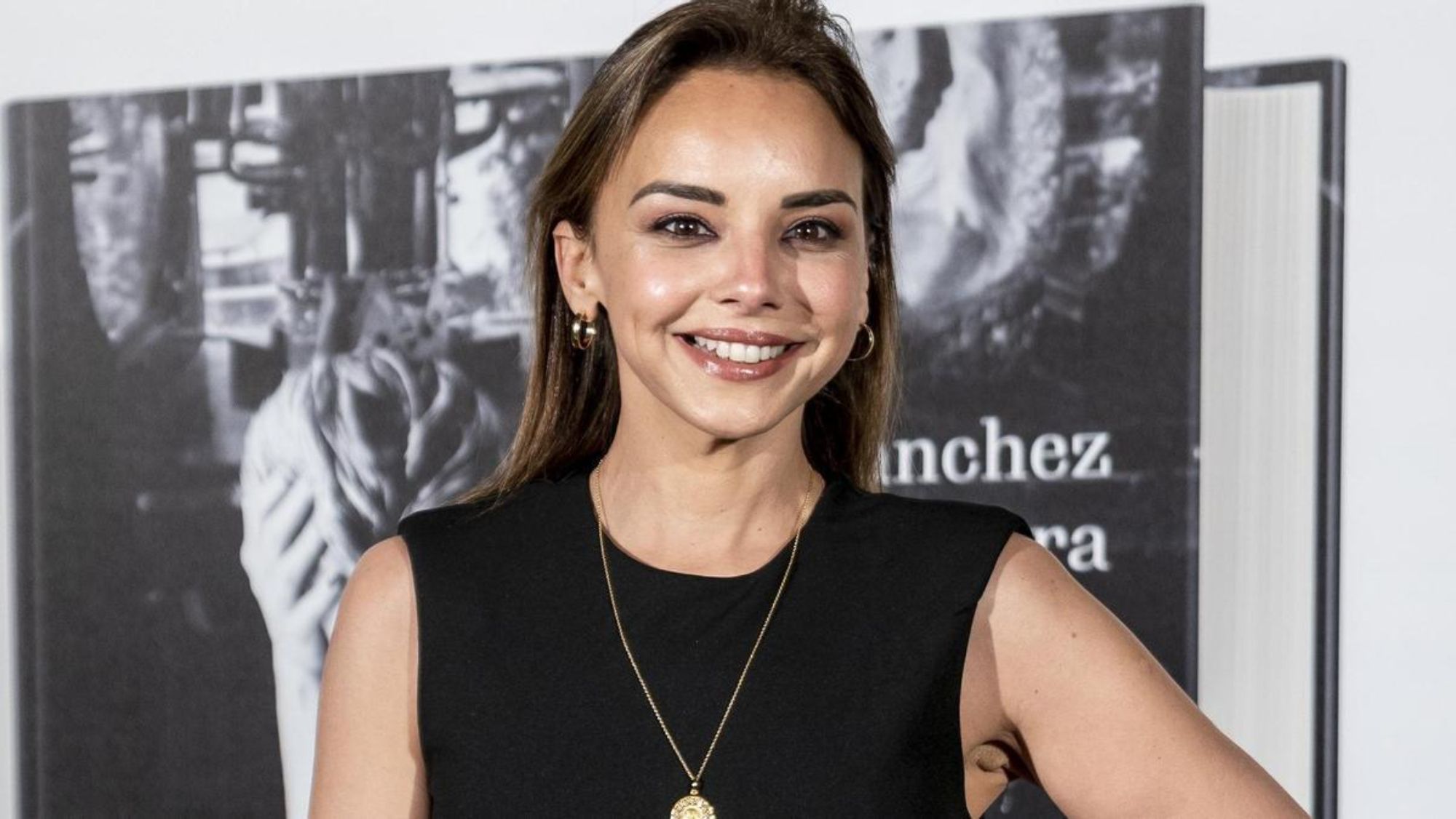 ¿Qué le pasa en la cara a Chenoa y por qué se enfada tanto cuando se lo dicen?